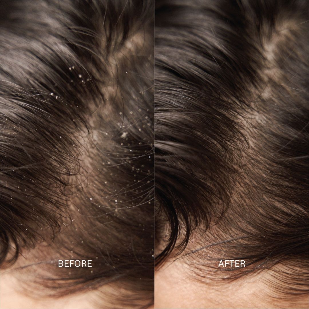 Hair & Scalp Treatments